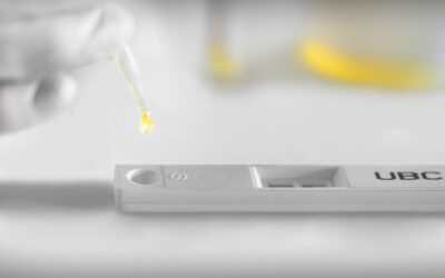 German study recommends UBC® Rapid to be added in the diagnostics and follow-up of high risk bladder cancer