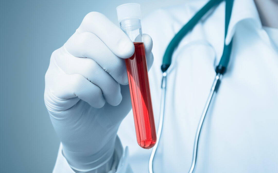 AroCell Strategy day 2020